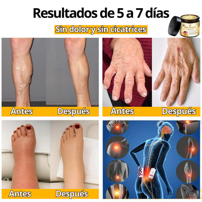 CREMA VENENO DE ABEJAS PARA ARTICULACIONES