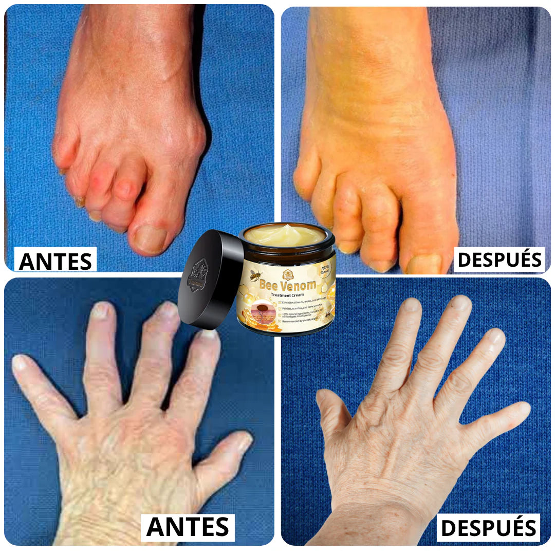 CREMA VENENO DE ABEJAS PARA ARTICULACIONES