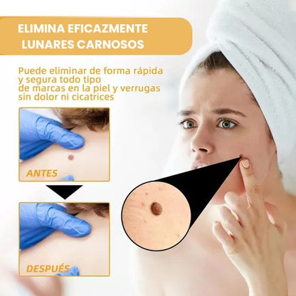 Tag Recede Eliminador de verrugas